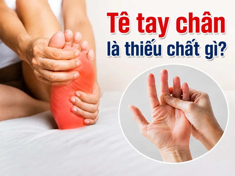 Tê tay chân có thể liên quan đến thiếu vitamin nhóm B hoặc rối loạn chất điện giải, nhưng cũng có nhiều nguyên nhân khác.